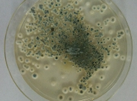 aspergillus