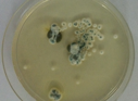 aspergillus06